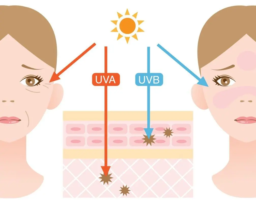 illustration showing depths of skin damage by UVA and UVB rays